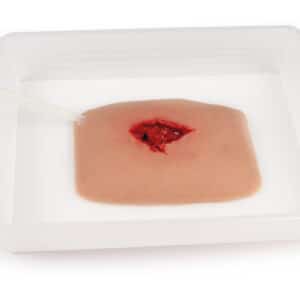 Wundmoulage Wound Packing – Bild 3